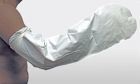 Gipshoes voor lange arm